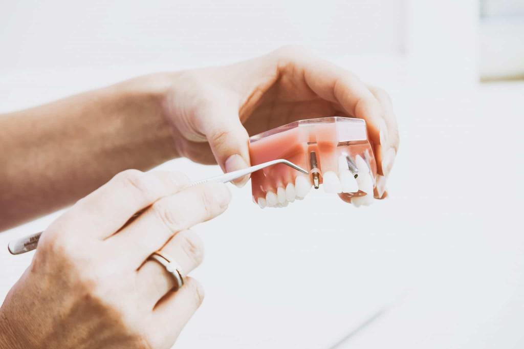 Dental Implants vs Dental Bridges – Which Should I Choose?