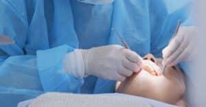 Dental Deep Cleanings