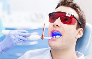 Porcelain Fillings