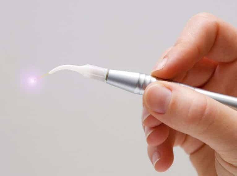 Laser Dentistry