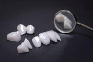 Cosmetic Dentist in Sarasota, FL at Sarasota Dentistry