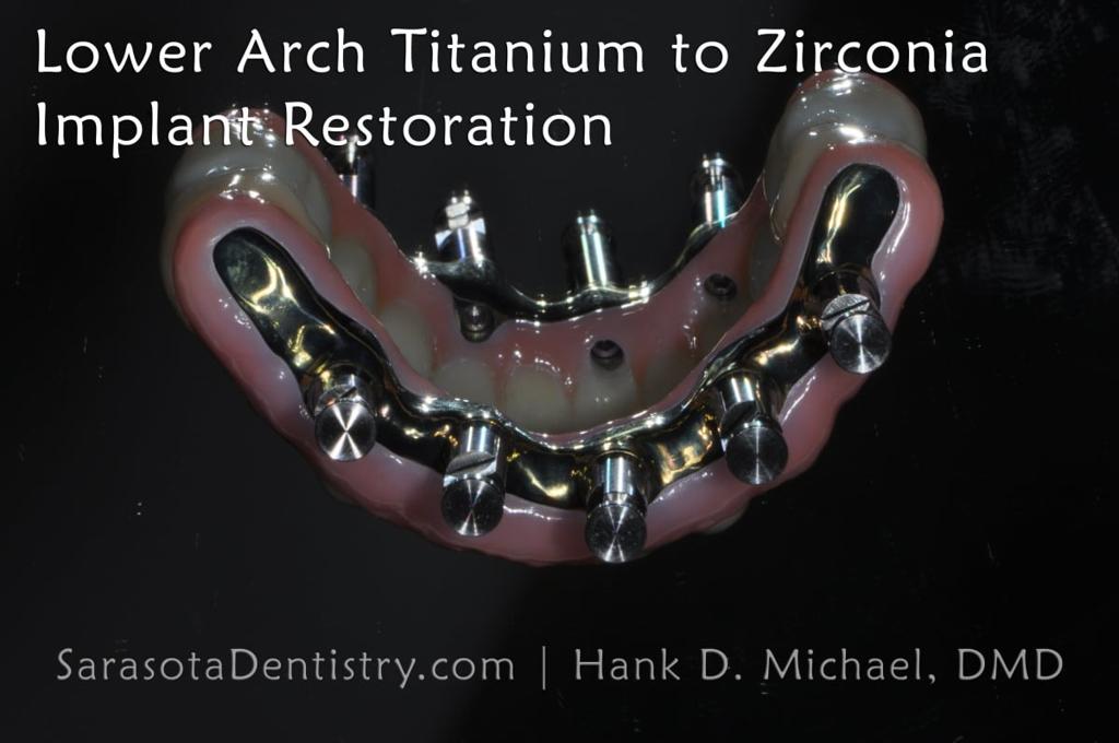 Full Arch Zirconia Dental Implant Restoration — view 11