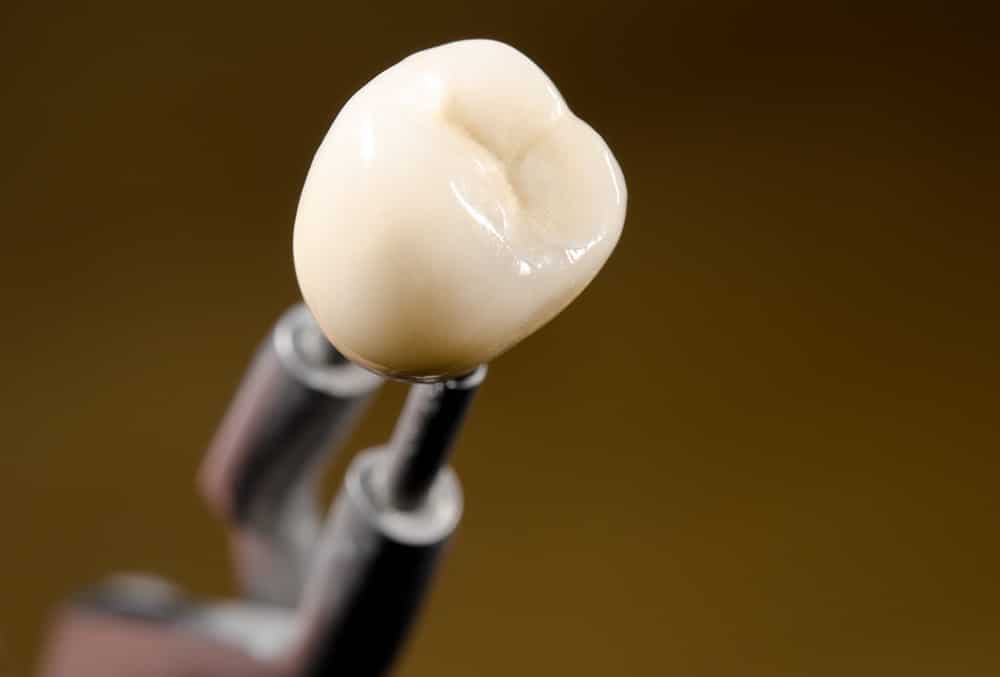 CEREC dental treatment