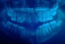 Dental CT Scan from Sarasota Dentistry