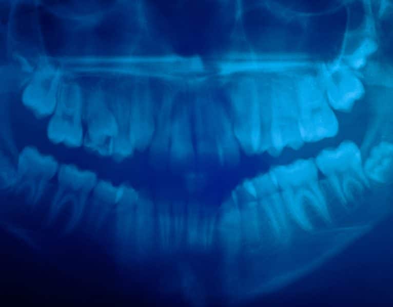 Dental CT Scan from Sarasota Dentistry