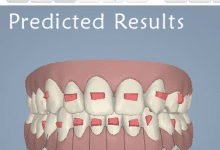 3D Dental Scan Image Predicted Results
