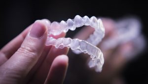 invisalign success with brad williams