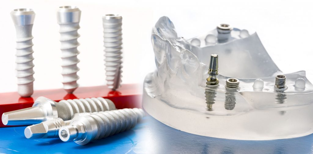 dental implants in clear dental model
