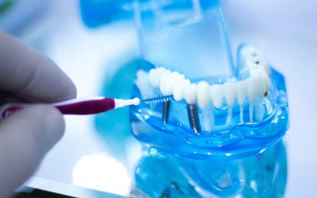 Deep Cleaning - Brushwell Dental & Implants