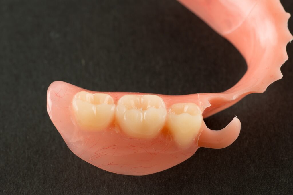 Lower Flexible Partial Dentures