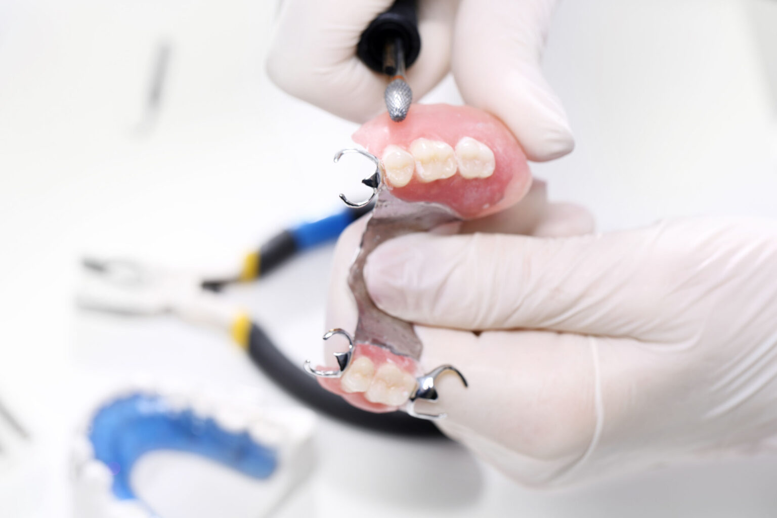 What Are Permanent Dentures? Cost & Advantages Sarasota Dentistry