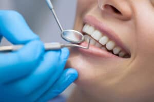 Dentist examining a patient's teeth